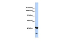 NFkB p100/p52 Antibody, Novus Biologicals 100 &mu;L; Unconjugated:Antibodies,
